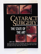 Cataract Surgery: The State of the Art
