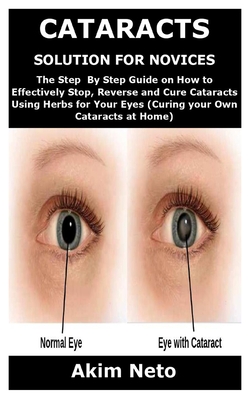 Cataracts Solution for Novices: The Step By Step Guide on How to Effectively Stop, Reverse and Cure Cataracts Using Herbs for Your Eyes (Curing your Own Cataracts at Home) - Neto, Akim