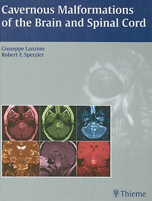 Cavernous Malformations of the Brain and Spinal Cord - Lanzino, Giuseppe (Editor), and Spetzler, Robert F. (Editor)