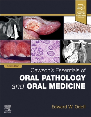 Cawson's Essentials of Oral Pathology and Oral Medicine - Odell, Edward W, MSc, PhD