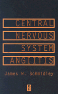 Central Nervous System Angiitis
