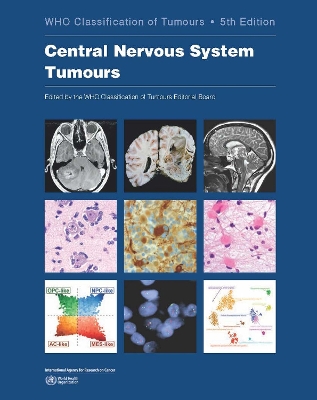 Central Nervous System Tumours: Who Classification of Tumours - Who Classification of Tumours Editorial Board (Editor)