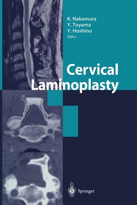 Cervical Laminoplasty - Nakamura, K (Editor), and Toyama, Y (Editor), and Hoshino, Y (Editor)