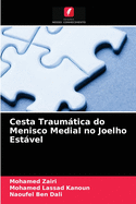 Cesta Traumtica do Menisco Medial no Joelho Estvel