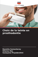 Choix de la teinte en prosthodontie