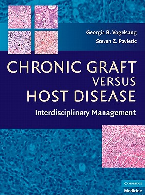 Chronic Graft Versus Host Disease: Interdisciplinary Management - Vogelsang, Georgia B (Editor), and Pavletic, Steven Z (Editor)
