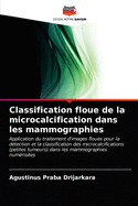 Classification floue de la microcalcification dans les mammographies