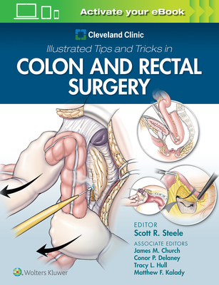 Cleveland Clinic Illustrated Tips and Tricks in Colon and Rectal Surgery - Steele, Scott