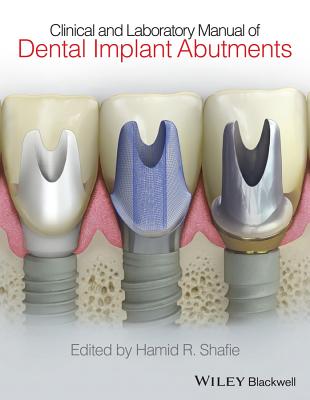 Clinical and Laboratory Manual of Dental Implant Abutments - Shafie, Hamid R
