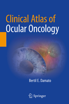 Clinical Atlas of Ocular Oncology - Damato, Bertil E.