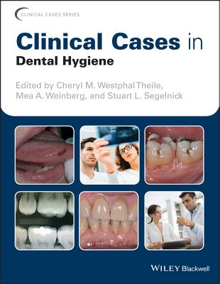 Clinical Cases in Dental Hygiene - Westphal Theile, Cheryl M. (Editor), and Weinberg, Mea A. (Editor), and Segelnick, Stuart L. (Editor)