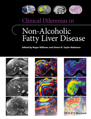 Clinical Dilemmas in Non-Alcoholic Fatty Liver Disease - Williams, Roger, and Taylor-Robinson, Simon D.