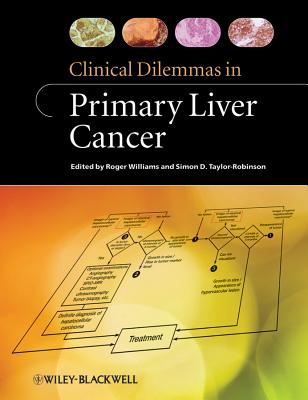 Clinical Dilemmas in Primary Liver Cancer - Williams, Roger (Editor), and Taylor-Robinson, Simon D. (Editor)