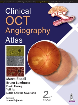 Clinical OCT Angiography Atlas - Rispoli, Marco, and Lumbroso, Bruno, and Huang, David