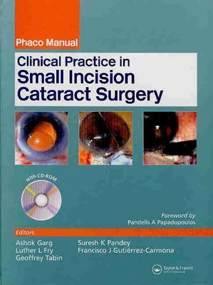 Clinical Practice in Small Incision Cataract Surgery - Fry, Luther L (Editor), and Garg, Ashok (Editor), and Guiterrez-Camona, Francisco (Editor)