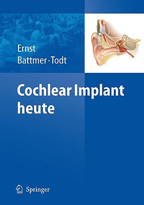 Cochlear Implant Heute - Ernst, Arne (Editor), and Battmer, Rolf-Dieter (Editor), and Todt, Ingo (Editor)