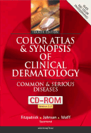 Color atlas and synopsis of clinical dermatology : common and serious diseases. - Fitzpatrick, Thomas B.