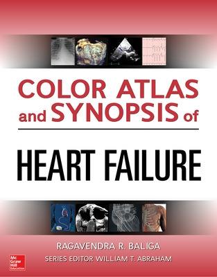 Color Atlas and Synopsis of Heart Failure - Baliga, Ragavendra