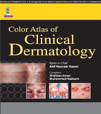 Color Atlas of Clinical Dermatology - Kazmi, Atif Hasnain, and Aman, Shahbaz, and Nadeem, Muhammad