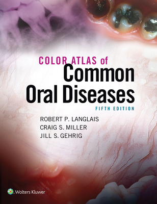 Color Atlas of Common Oral Diseases - Langlais, Robert P