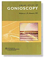 Color Atlas of Gonioscopy