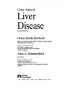 Color Atlas of Liver Disease