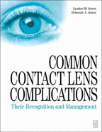 Common Contact Lens Complications: Their Recognition and Management