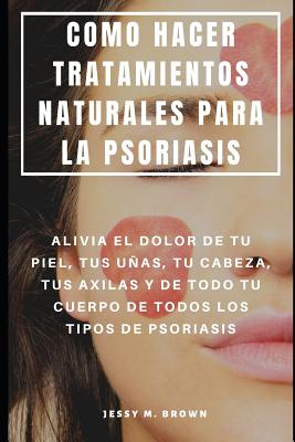 Como Hacer Tratamientos Naturales Para La Psoriasis: Alivia El Dolor de Tu Piel, Tus Uas, Tu Cabeza, Tus Axilas Y de Todo Tu Cuerpo de Todos Los Tipos de Psoriasis - Brown, Jessy M