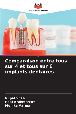 Comparaison entre tous sur 4 et tous sur 6 implants dentaires - Shah, Rupal, and Brahmbhatt, Real, and Varma, Monika