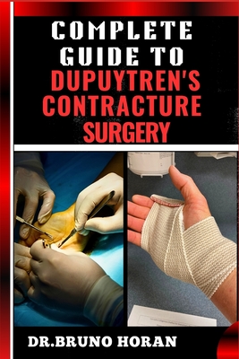 Complete Guide to Dupuytren's Contracture Surgery: Comprehensive Manual To Advanced Techniques, Recovery, and Best Practices for Optimal Oral Health - Horan, Bruno, Dr.