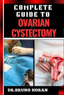 Complete Guide to Ovarian Cystectomy: Essential Handbook To Expert Techniques, Minimally Invasive Procedures, Recovery Tips, And Patient Care - Horan, Bruno, Dr.