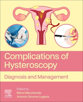 Complications of Hysteroscopy: Diagnosis and Management - Manchanda, Rahul (Editor), and Lagan, Antonio Simone (Editor)