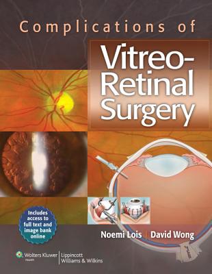 Complications of Vitreo-Retinal Surgery with Access Code - Lois, Noemi, Dr., MD, and Wong, David