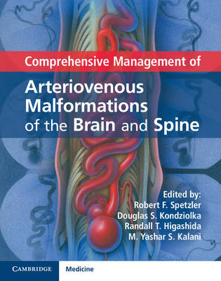 Comprehensive Management of Arteriovenous Malformations of the Brain and Spine - Spetzler, Robert F. (Editor), and Kondziolka, Douglas S. (Editor), and Higashida, Randall T. (Editor)