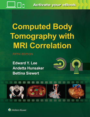 Computed Body Tomography with MRI Correlation - Lee, Edward Y., and Hunsaker, Andetta, MD, and Siewert, Bettina, MD, MPH