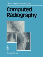 Computed Radiography