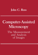 Computer-Assisted Microscopy: The Measurement and Analysis of Images