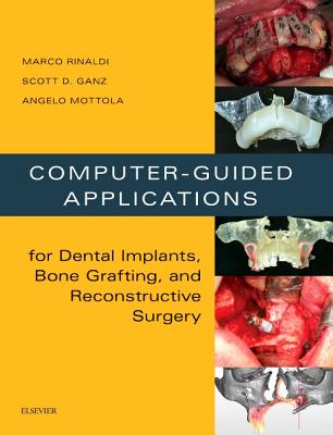 Computer-Guided Applications for Dental Implants, Bone Grafting, and Reconstructive Surgery (Adapted Translation) - Rinaldi, Marco, and Ganz, Scott D, and Mottola, Angelo
