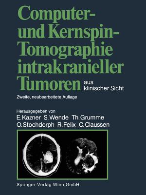 Computer- Und Kernspin-Tomographie Intrakranieller Tumoren Aus Klinischer Sicht - Kazner, Ekkehard (Editor), and Claussen, Claus (Editor), and Wende, Sigurd (Editor)