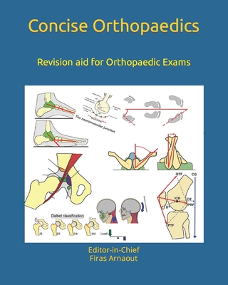 Concise Orthopaedic Notes: Revision aid for FRCS, EBOT , SICOT and Board Examinations - Arnaout Frcs, Firas