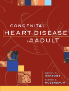 Congenital Heart Disease Adult