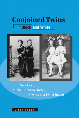 Conjoined Twins in Black and White: The Lives of Millie-Christine McKoy and Daisy and Violet Hilton - Frost, Linda (Editor)