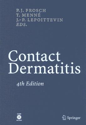 Contact Dermatitis - Frosch, P J (Editor), and Menne, T (Editor), and Lepoittevin, J -P (Editor)