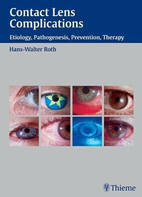 Contact Lens Complications: Etiology, Pathogenesis, Prevention, Therapy - Roth, Hans Walter