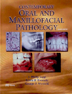 Contemporary Oral and Maxillofacial Pathology