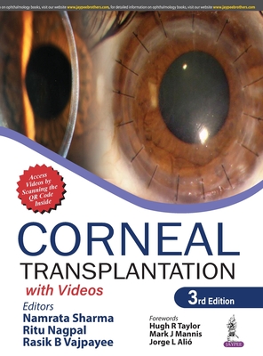 Corneal Transplantation: with Videos - Sharma, Namrata, and Nagpal, Ritu, and Vajpayee, Rasik B