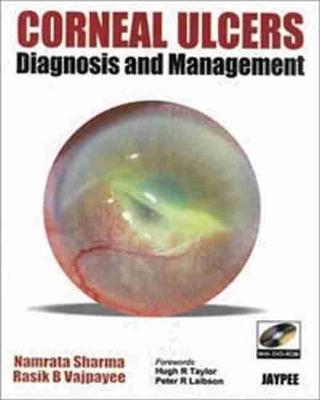 Corneal Ulcers Diagnosis and Management - Sharma, Namrata, and Vajpayee, Rasik B