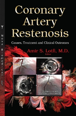 Coronary Artery Restenosis: Causes, Treatment and Clinical Outcomes - Lotfi, Amir S (Editor)