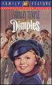 Shirley Temple: Dimples