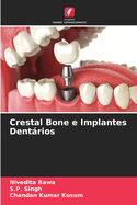 Crestal Bone e Implantes Dentrios